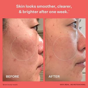 Suero Refinador de Piel Glass Skin de Lance Private Label, Corrector de <span class=keywords><strong>Manchas</strong></span> Oscuras Líquido Orgánico <span class=keywords><strong>para</strong></span> el Rostro con Vitamina B3 y <span class=keywords><strong>Aloe</strong></span> Vera - Product Image 5
