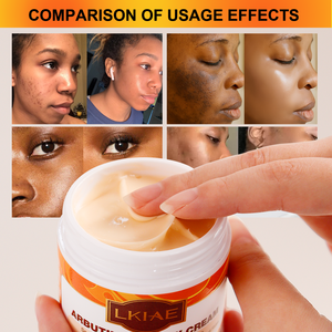 Crème <span class=keywords><strong>Visage</strong></span> à l'Arbutine 50ml la Plus Vendue – Super Éclaircissante, Hydratante, Anti-Âge, Répare les Peaux Sèches, Atténue les Cicatrices et l'Acné – Nuit - Product Image 3