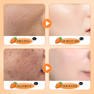 Set Siero ai Semi di Carota - Routine di Cura della Pelle Idratante e Nutriente per Pelle Secca e Sfogliata, Trattamento Illuminante Ricco di Antiossidanti - Product Image 4