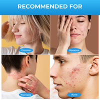 Vente en gros et personnalisation : Crème apaisante douce à base d'extraits végétaux naturels pour l'eczéma, soin quotidien de la peau du corps
