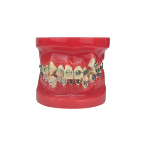 Modelo de Maloclusión Dental para Prácticas de Estudiantes de Odontología, Enseñanza, Entrenamiento, Comunicación, Equipo Médico Bucal - Product Image 3