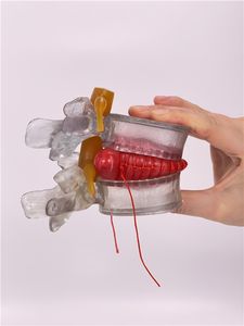 Modèle anatomique éducatif de colonne vertébrale lombaire en PVC pour la maladie des disques intervertébraux humains - Product Image 4