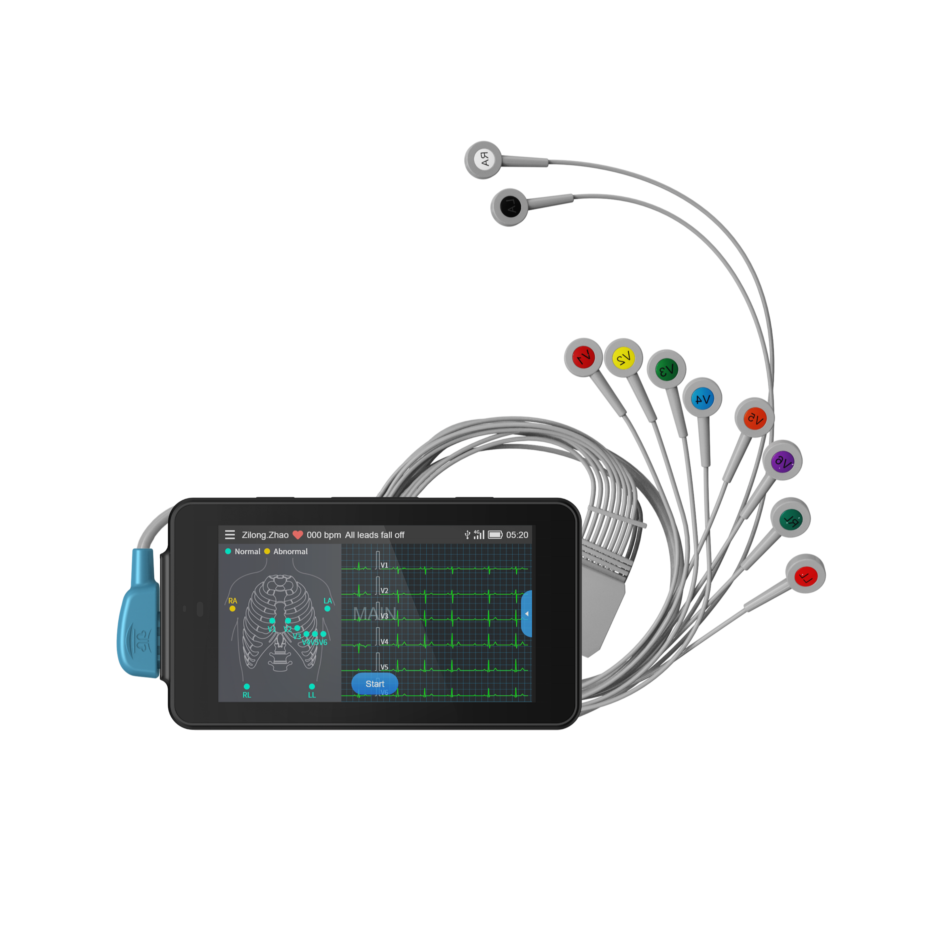 24 saat el monitör taşınabilir EKG en iyi seçim el taşınabilir EKG kablosuz EKG