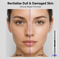 Stylo à micro-aiguilles 0,15 mm pour l'application de sérum, formule réparatrice clinique, éclaircissant, unifiant le teint, anti-âge, lissant, stylo à essence premium