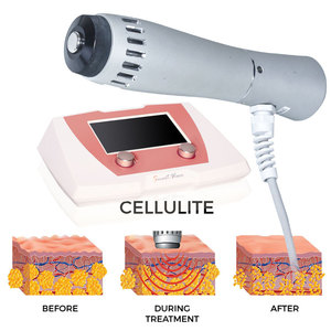 Dispositivos Cosméticos para Eliminación de Grasa Facial y Corporal para Uso <span class=keywords><strong>en</strong></span> Clínicas de Bienestar y Belleza - Product Image 6