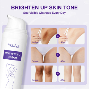 Crema Sbiancante per Ascelle OEM, Cura del Corpo, Rimozione Macchie Scure, Crema Schiarente alla Vitamina C per Ascelle e Zone Intime - Product Image 3