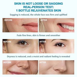 O'KADY Crème pour le <span class=keywords><strong>visage</strong></span> au collagène et au rétinol 50ml | Hydratant anti-âge raffermissant éclaircissant hydratation en profondeur utilisation <span class=keywords><strong>de</strong></span> <span class=keywords><strong>jour</strong></span> - Product Image 6