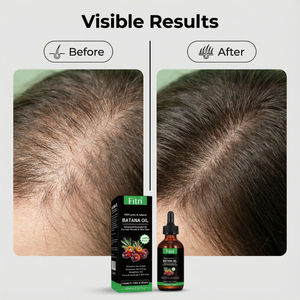 Óleo Capilar Nutritivo 2 em 1 com Esqualano para Cuidado do Couro Cabeludo, Essência Orgânica Natural Pura, Marca Própria, Vegetarianismo Puro - Product Image 6