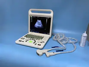 Máquina de ultrassom cardíaco 3d 4d ecografo médico portátil doppler para ginecologia