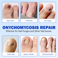 Patch réparateur d'ongles ELAMEI Herbal 8 heures, patch réparateur et protecteur des ongles des orteils contre les champignons