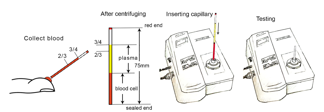 Factory price medical Total bilirubin meter Baby neonatal transcutaneous medical equipment bilirubin test analyzer