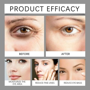 PDRN Yüz Serumu Kore Somon DNA Onarım Formülü Beyazlatıcı Anti-Aging İnce Çizgiler Şişlik Nemlendirme 30ml Tüm Cilt Tipleri için - Product Image 4