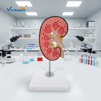 Modèle anatomique de rein avec glande suréchide en PVC, taille réelle 3X, 2 parties, pour la formation scientifique médicale dans les écoles