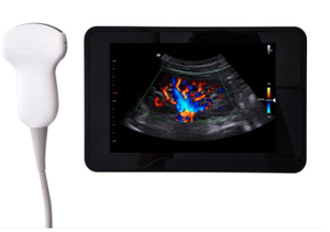 작은 동물을위한 전문 고속 스캔 수의학 컬러 도플러 초음파 선형 배열 선형 초음파 - Product Image 2