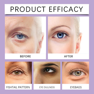 Crème pour les yeux triple action au rétinol, hydrate en douceur, soigne la peau douce, réduit les ridules autour des yeux. - Product Image 6