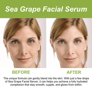 Venta directa de fábrica adecuada para todos los tipos de piel más firme y brillante obteniendo suero facial de día y de noche - Product Image 5