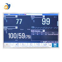 Dizüstü Bilgisayarlar için 15,6 İnç 1920x1080 TFT LCD Ekran, 30-Pin Konnektör