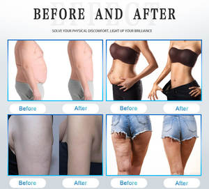 Appareil de <span class=keywords><strong>Massage</strong></span> Vibrant Professionnel G5 2024 pour la Perte de Graisse et la Réduction de la Cellulite - Product Image 6