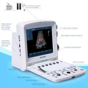 <span class=keywords><strong>Edan</strong></span> U50 Portable Color Doppler <span class=keywords><strong>Ultrasound</strong></span> Pemindai Ultrasonografi Superior - Product Image 3