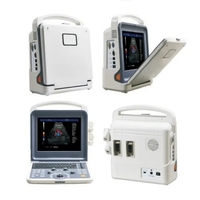 Système de diagnostic par ultrasons Doppler couleur 4D à prix compétitif 6 langues ultrasons portables