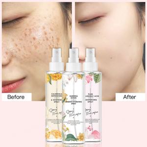 Tónico Facial Hidratante y Calmante al por Mayor, Spray Facial - Product Image 2