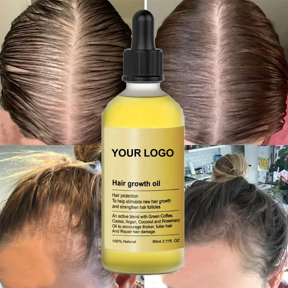 Doğal organik biberiye hint badem saç büyüme yağı nemlendirir ve koşulları saç dökülmesi tedavisi bakım Serum ürünleri