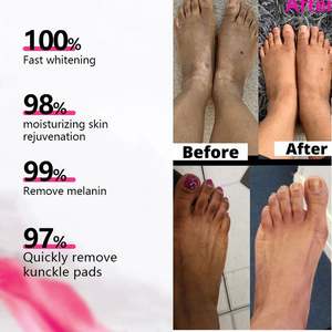 น้ำมันขจัดรอยด่างดำเพื่อผิวกระจ่างใสน้ำมันลอกข้อนิ้วสีเหลืองเข้มทำให้ขาวขึ้น - Product Image 3