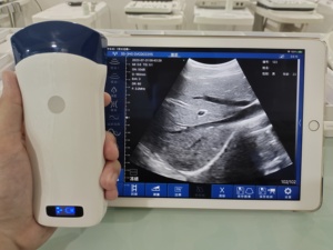 Sonda Inalámbrica DMU36 Convexa, Ecógrafo Doppler Color de 128 Elementos con CF/PW/PDI para Uso Abdominal y Obstétrico - Product Image 3