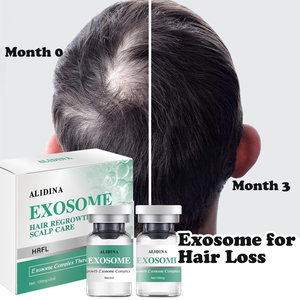 S Kit de rajeunissement topique des cheveux et du cuir chevelu EGF Peptides croissance des cheveux chauve amélioration cellules souches repousse des cheveux cuir chevelu <span class=keywords><strong>tonique</strong></span> nourrissant - Product Image 3