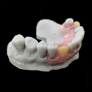 Protesi parziali flessibili personalizzate <span class=keywords><strong>Valplast</strong></span> cina <span class=keywords><strong>Dental</strong></span> <span class=keywords><strong>Lab</strong></span> prezzo consegna veloce - Product Image 4