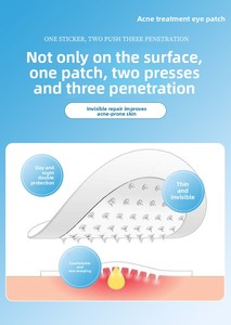 Микронидл-патчи от акне: гидроколлоидные саморазлагающиеся микропули для лица, для всех типов кожи – от пост-акне, темных пятен, покраснений - Product Image 5