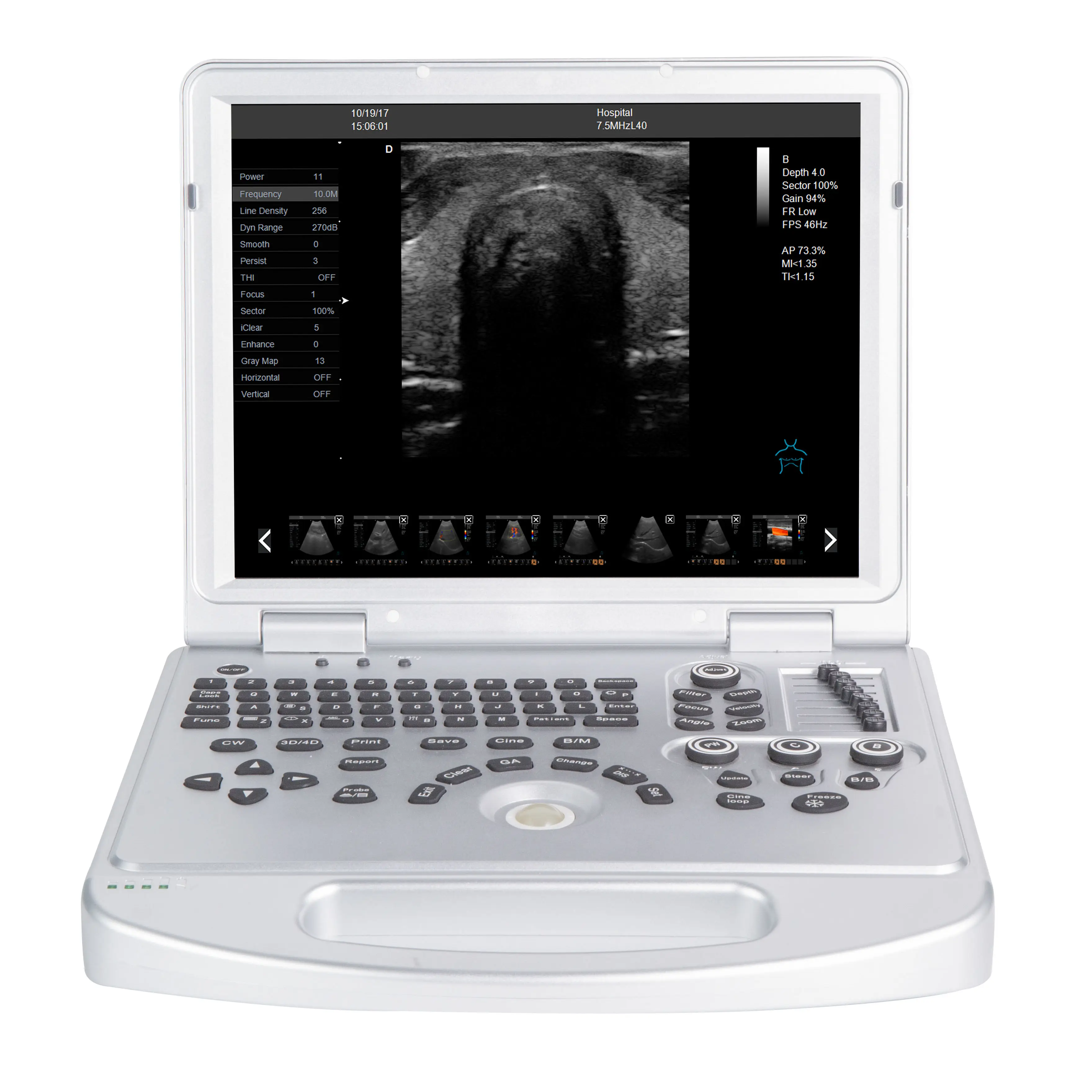 Scanner digitale ad ultrasuoni per laptop veterinario con strumenti medici a colori professionali