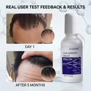 Suero Profesional para el Crecimiento del Cabello, Fórmula Avanzada <span class=keywords><strong>RCP</strong></span>+A, Cuidado Clínico para la Densidad del Cabello, para Cabello Debilitado por el Postparto y el Estrés - Product Image 6