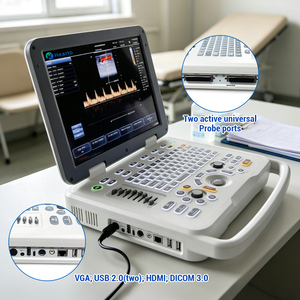 Appareil d'échographie Doppler couleur portable pour ordinateur portable, scanner de diagnostic médical avec <span class=keywords><strong>sonde</strong></span> convexe linéaire transvaginale - Product Image 6