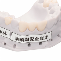 Couronne en Zircone Ecolab Personnalisée pour Laboratoires et Cliniques Dentaires : Incrustation, sur-couche et superposition en verre-céramique et porcelaine pour une restauration dentaire hautement esthétique et durable