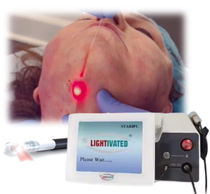 Mesin Terapi Laser Diode 1470nm EndoLaser Pengencangan Wajah 980 Gelombang Ganda Laser Injeksi Lemak Pengencangan Kulit Body Tite - Product Image 1