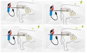 Kit d'insémination artificielle numérique IA pour animaux (chèvre, mouton, porc, bovin) avec fonctions de diagnostic - Product Image 3
