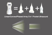Escáner de ultrasonido con cargador inalámbrico WIFI de 192 elementos 3 en 1 Doppler en color Phased Array Convex Cardiac