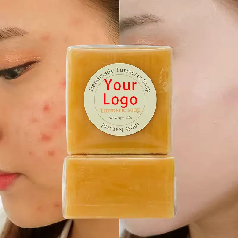 Label pribadi buatan tangan perawatan kulit organik Anti jerawat pemutih tubuh sabun mandi Bar pembersih wajah sabun kunyit buatan tangan