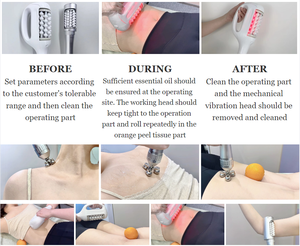 Máquina de Masaje Reductora Corporal Anticelulitis Slimsphere con Rotación de 360 Grados - Product Image 3