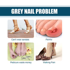 Crème nourrissante pour les ongles South <span class=keywords><strong>Moon</strong></span> Natural Nails Anti-fongique Restore Healthy Herbal Nail Cream - Product Image 5