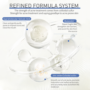 เซรั่มบำรุงสิว<span class=keywords><strong>ผง</strong></span>น้ำสูตรพิเศษรักษาสิวมีประสิทธิภาพความเร็วสูง - Product Image 2