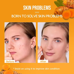 Nghệ axit amin rửa mặt với được xây dựng trong bàn chải Collagen truyền bong bóng mousse cho sáng làm sạch sâu tất cả các loại da - Product Image 5