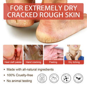 Crema para el Cuidado de los Pies 100% Natural al por Mayor, para Reparación de Talones, Exfoliación de Piel Muerta y Prevención de Agrietamiento y Callosidades - Product Image 3