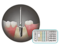 Kit de confection d'implants dentaires Osstem / Outil de réparation orale pour implants dentaires / Ensemble de forets pour implants