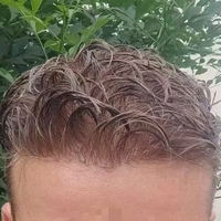 Offre Spéciale : Prothèses Capillaires Homme Ultra-Fines (0,02 mm) en PU, Modèle V-Lopped, Effet Naturel