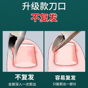 Alicates de acero inoxidable, juego de cortaúñas, cortaúñas para pies, cuchillo para pedicura, herramientas de alicates de punta fina para el hogar - Product Image 3