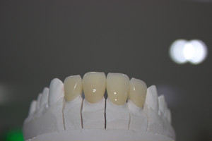 De alta calidad de CAD/CAM personalizado de circonio corona Dental - Product Image 2