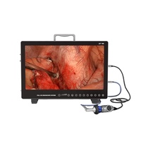 Caméra endoscopique intégrée portable Full HD IKEDA YKD-9122 pour laparoscopie, hystéroscopie et chirurgie spinale