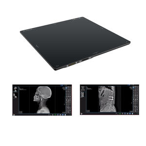Rilevatore a schermo piatto apparecchiature radiologiche a raggi x dr radiografia macchina digitale xray 17x17 rilevatore wireless a schermo piatto - Product Image 4